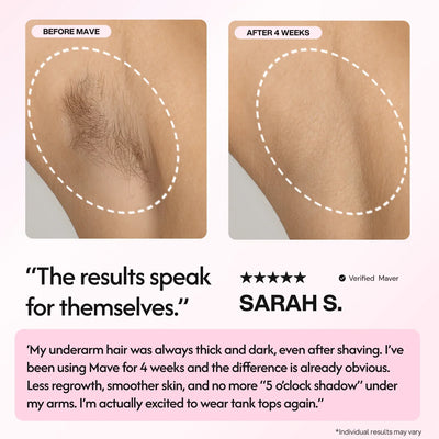 Mave IPL Hair Removal Handset - Smuuv Body