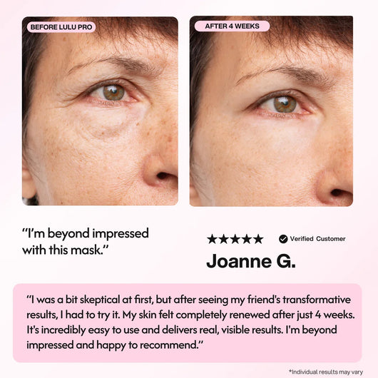 Lulu Pro LED Light Therapy Mask - Smuuv Body